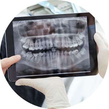 Dr. Charles Alencar - Invisalign Ortodontia Aparelho invisível